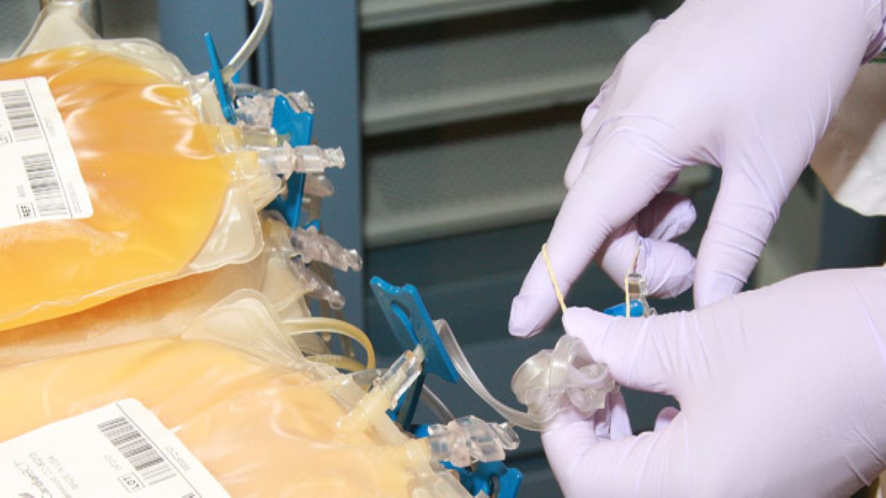 اهمیت پلاسمافرزیس